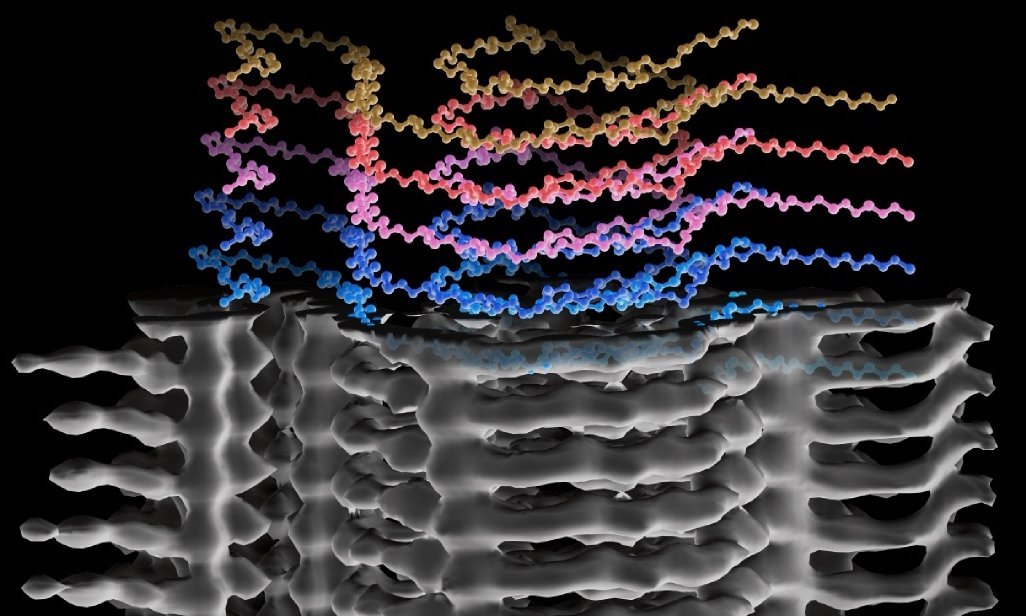 Cryo-EM