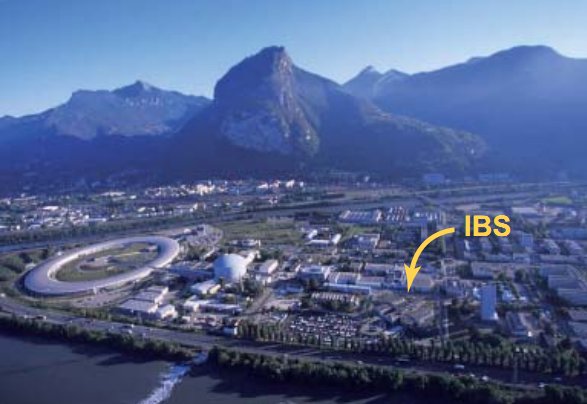 ibs_1b